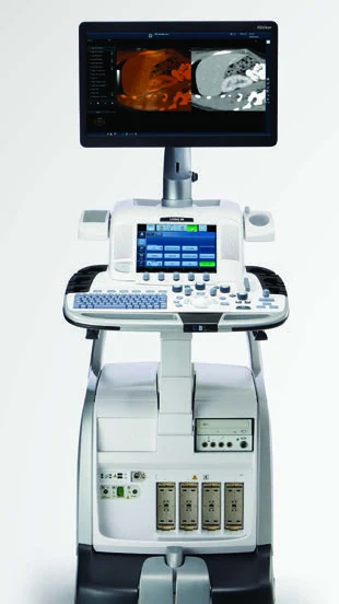 GE LOGIQ E9 XDclear ultrasound system